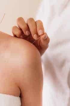 طب سوزنی02