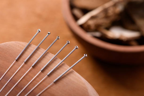 سوزن طب سوزنی از نمای نزدیک