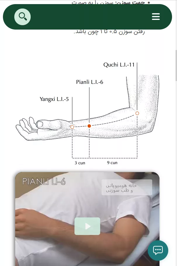 نقطه طب سوزنی 03