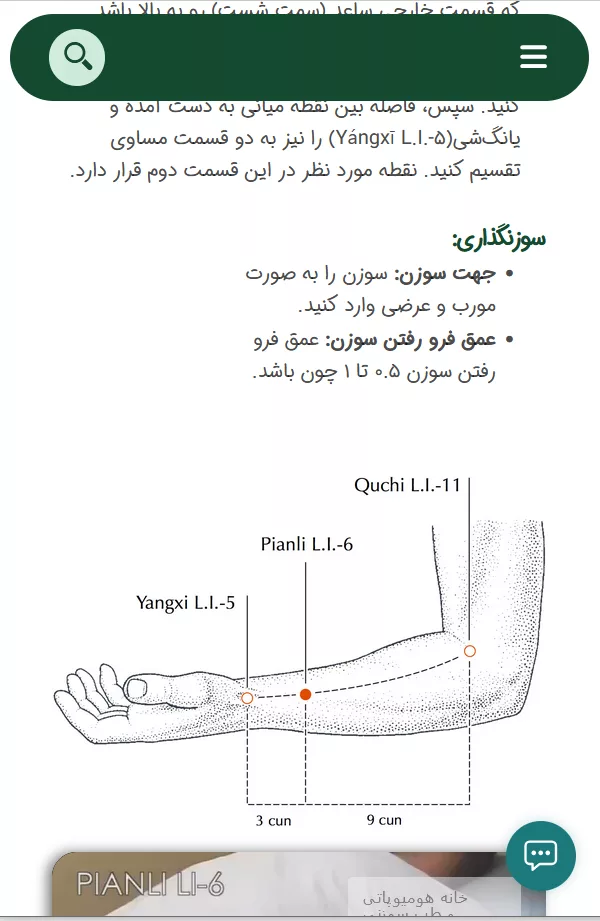 نقطه طب سوزنی 02
