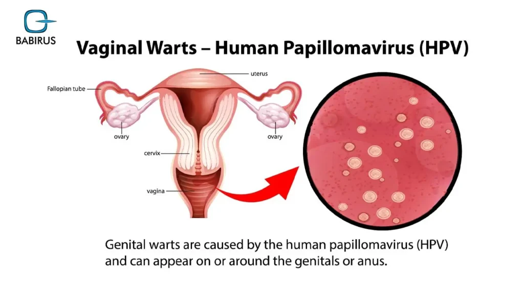 Human-Papillomavirus